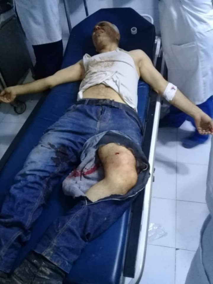 Efrîn tê topbarankirin.. Qurbanî hene